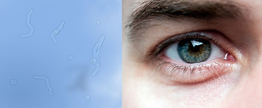 kukacok, retina, úszkáló fehérvérsejtek, szem, optikai illúzió